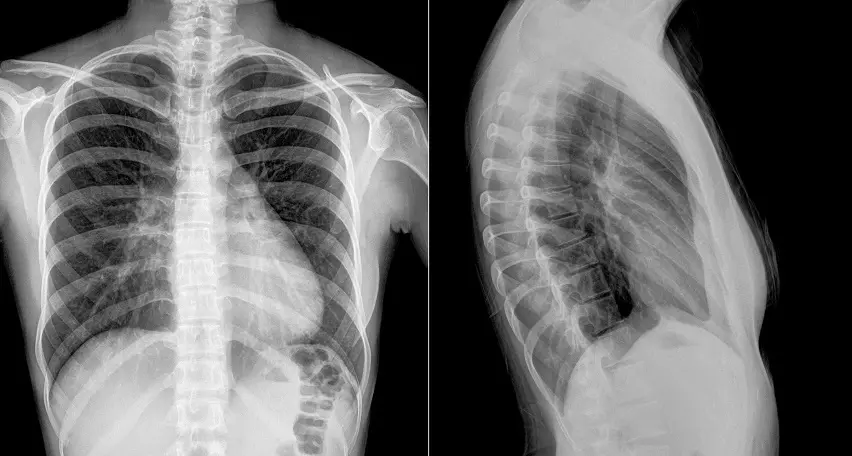 Какие заболевания диагностирует заключение рентгеновского снимка